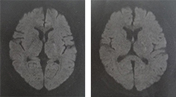 2014-2015年MRI画像